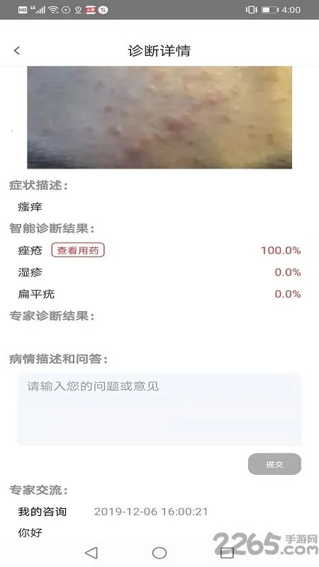 Ƥ�������ѡҩ(Ƥ������app)v1.0.4 �ٷ������ͼ