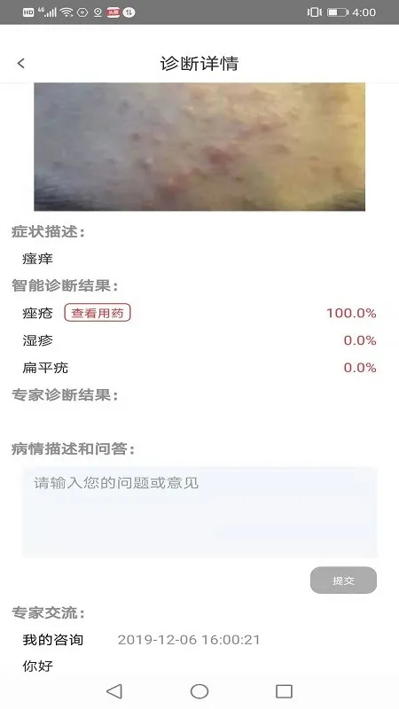 Ƥ�������ѡҩ(Ƥ������app)