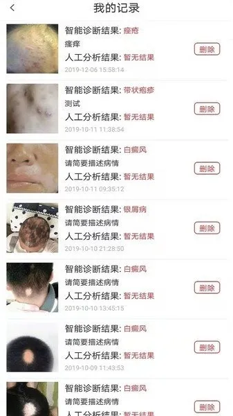 Ƥ�������ѡҩ(Ƥ������app)