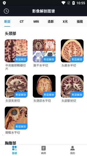 Ӱ�����ͼ�װ�׿���ֻ���